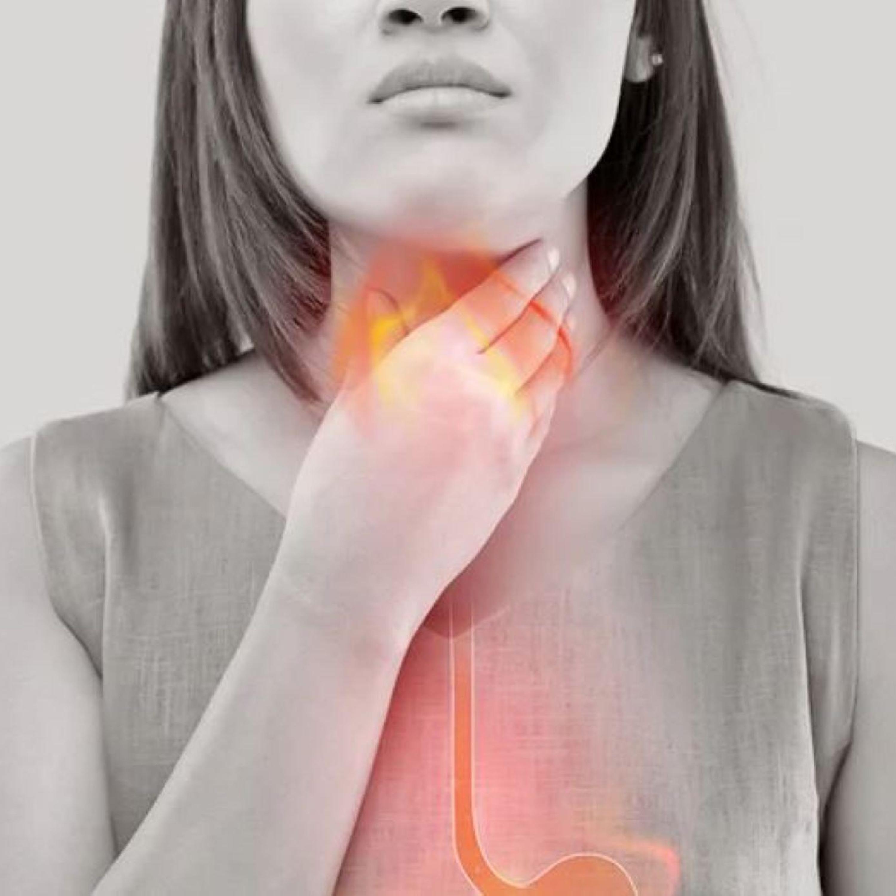The Truth About GERD: 6 Easy Steps to Reduce Acid Reflux from The Holistic Navigator